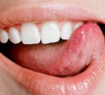 Dental initiative uses leaflets to warn of little-known disease Dental initiative uses leaflets to warn of little-known disease
